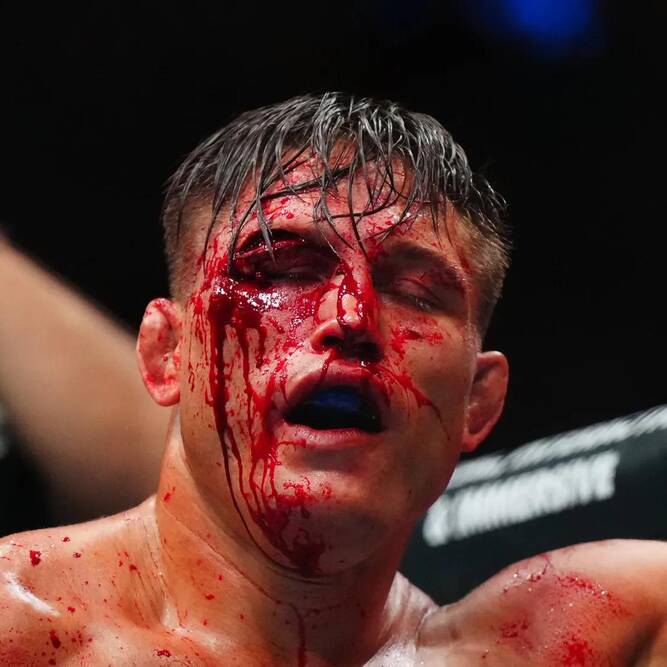 Injured portrait